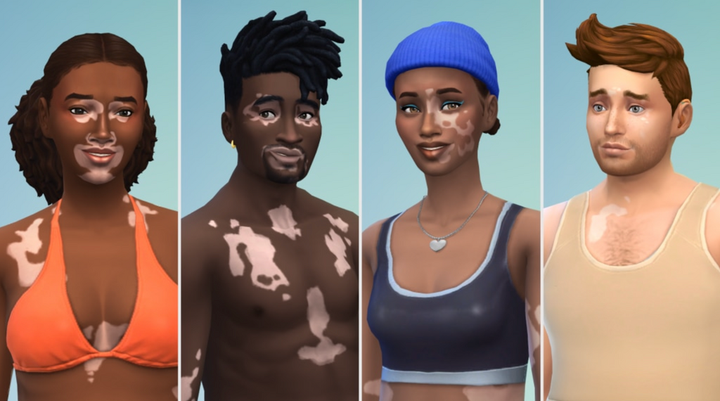 The Sims 4 Adds New Vitiligo Skin Option In Free Update